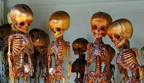 Preserved Pygmy Skeletons